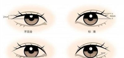 ​怎么能变双眼皮(怎样才能变为双眼皮)