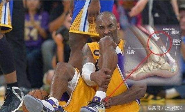 三张图告诉你，跟腱断裂有多恐怖！