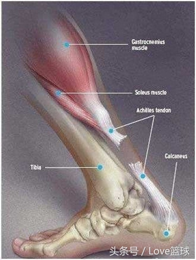 三张图告诉你，跟腱断裂有多恐怖！
